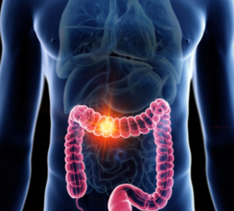 Gastroenterology